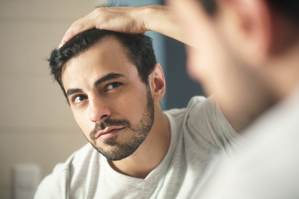 Eflúvios e alopecia androgenética